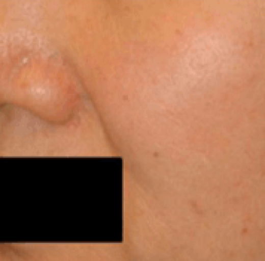 Before/After Image
